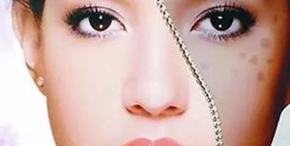 上海眼部修復(fù)專家推薦，治療眼部問題可信賴！