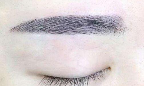 北京市優(yōu)質(zhì)微整形醫(yī)院推薦，絕對讓你滿意！