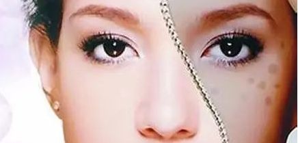 周一雄如何預約雙眼皮手術(shù)？案例分享與價格真實評估