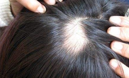 重慶鵬愛醫(yī)療美容醫(yī)院的特色項(xiàng)目與醫(yī)生團(tuán)隊(duì)是否一鍵獲取可信賴？