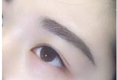 重慶銅雀臺(tái)地區(qū)雙眼皮手術(shù)頂級(jí)醫(yī)生推薦！詳細(xì)收費(fèi)一覽表