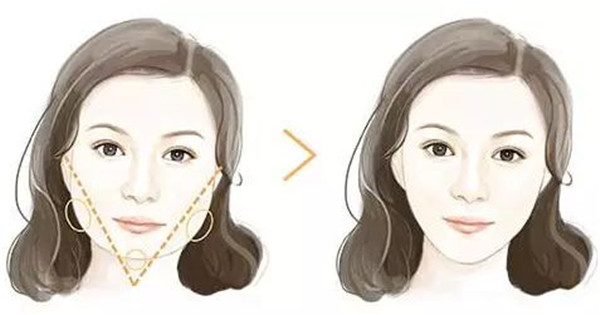 深圳吸脂修復(fù)醫(yī)院哪家專業(yè)？這八強(qiáng)機(jī)構(gòu)到底有何絕技？