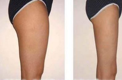 廣州拉皮口碑醫(yī)院推薦：華美與中家醫(yī)醫(yī)生榜上有名