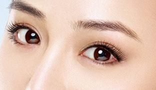 成都米蘭柏羽雙眼皮曝光！醫(yī)生做雙眼皮風(fēng)格如何？對(duì)比照片供參考