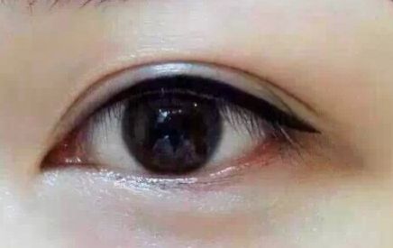 上海9院專家分享軟骨隆鼻案例，LiQingfeng的技術(shù)備受推崇！