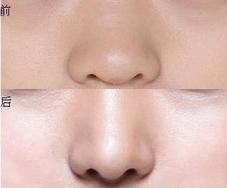 上海當(dāng)?shù)貍涫芡瞥绲捻敿?jí)眼科專家排行榜