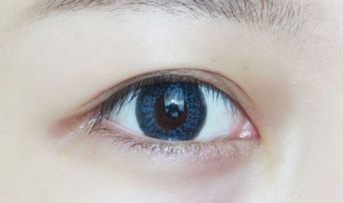 鄭州陳遠琨和南京周順波醫(yī)師比較！實力大PK，看看各自特長和隆鼻案例分享！你真不敢錯過！