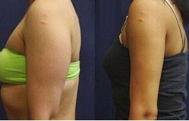 深圳優(yōu)質(zhì)鼻部綜合醫(yī)院排行榜，推薦權(quán)威醫(yī)療機(jī)構(gòu)！