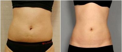 蘇州美容整形醫(yī)院綜合實(shí)力巔峰，排名前三不能錯過