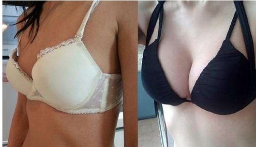 長沙雙眼皮手術(shù)：田芳斌與解燦哪位醫(yī)生更優(yōu)秀？前五專家詳細(xì)介紹！有必要留存~