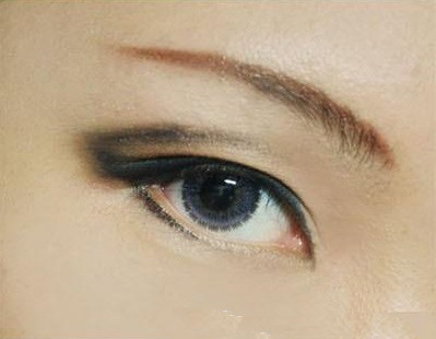 合肥有哪些口碑好的醫(yī)院能有效治療黑眼圈？如何選擇適合自己的醫(yī)院治療黑眼圈？