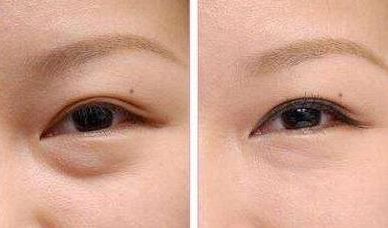 上海九院種植牙醫(yī)生推薦：這幾位牙醫(yī)技術(shù)獨(dú)特，深受患者好評(píng)！