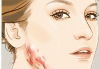 北京哪家醫(yī)院可以洗紋身呢？