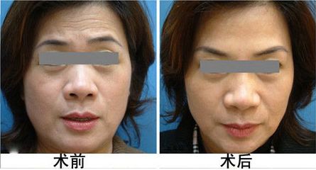 廣安阿藍(lán)醫(yī)院整形科評(píng)價(jià)，是否正規(guī)？地址詳細(xì)一覽