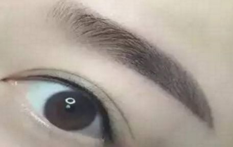 哈爾濱醫(yī)科大學二院最新整形去痦子技術揭秘，讓肌膚恢復純凈光潔