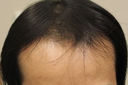 哪家醫(yī)療整形醫(yī)院是貴陽省內(nèi)口碑比較好的選擇？