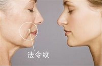 美麗改變，趙德星鼻子整形前后對(duì)比，驚艷有度！