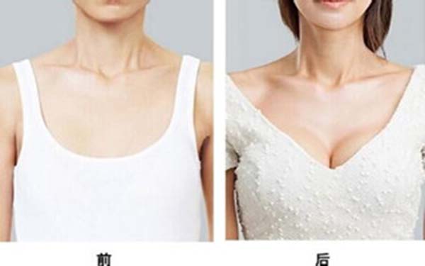深圳非凡整形醫(yī)院真的正規(guī)可靠嗎？整形手術(shù)價(jià)格貴不貴，醫(yī)生怎么樣，口碑評(píng)價(jià)怎么樣？