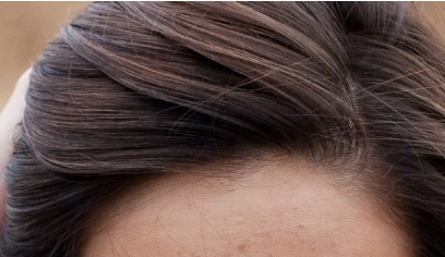 成都藝星醫(yī)療美容醫(yī)院熱門項(xiàng)目有哪些值得一試的選擇？如何快速了解成都藝星醫(yī)療美容醫(yī)院的熱門項(xiàng)目？