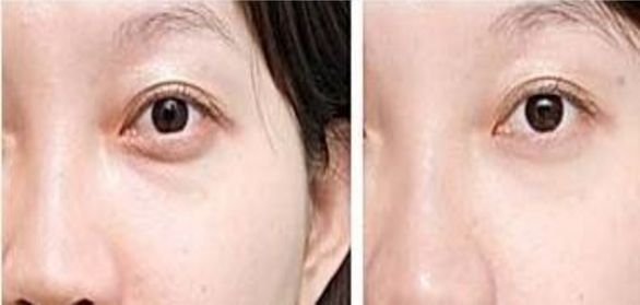 上海排名靠前的整形醫(yī)院推薦，想知道哪家好？最受歡迎的三甲醫(yī)療機(jī)構(gòu)名單已公布！