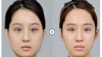 【2024】杭州十大值得信賴的整形美容醫(yī)院推薦！