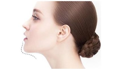 陸軍總院美容科：專家團(tuán)隊(duì)引領(lǐng)腰部吸脂，成功案例揭秘！