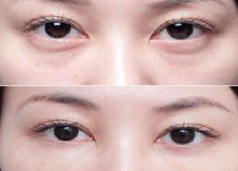 學生黨必備！性價比超高的祛黑眼圈眼霜推薦