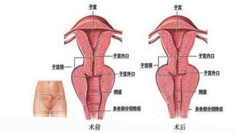 北京最佳乳房再造醫(yī)院排行榜，八強(qiáng)環(huán)境多元，知名醫(yī)生鼎力支持