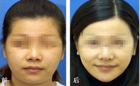 昆明乳房整形哪家醫(yī)院專業(yè)可信？榜單前五推薦，選你中意的