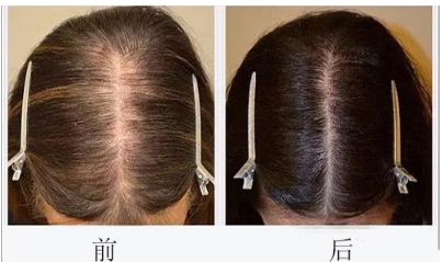 鄭州整形隆胸口碑佳的十大醫(yī)院推薦