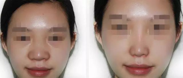 濟(jì)南藝星官網(wǎng)真的靠譜嗎？值得信賴的技術(shù)與專家團(tuán)隊(duì)火熱推出價(jià)格表