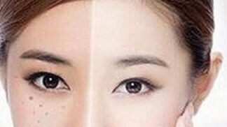 獨家揭秘！了解重慶楊武林醫(yī)生的墊下巴整形全過程