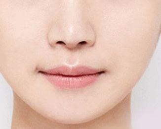 北京下頜角整容試點名醫(yī)風采，技術專業(yè)深受口碑推崇