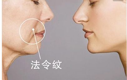 長沙田毅雙眼皮手術新穎獨特，引領2023最新潮流