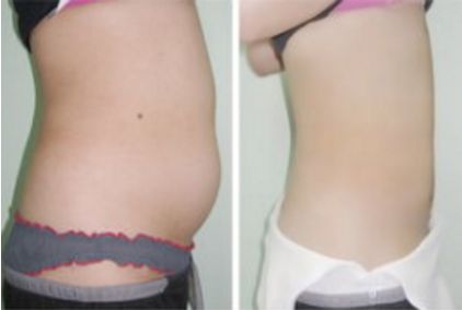 長沙哪家拉皮手術(shù)醫(yī)院靠譜？幾家實(shí)力口碑不錯，快來看看