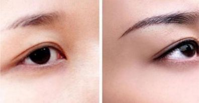 重慶頂尖眼部整形醫(yī)生、醫(yī)院排行榜一覽