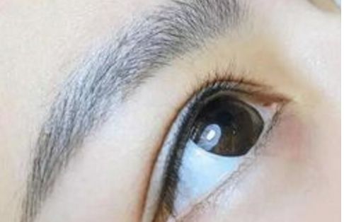 廣州名麗醫(yī)療美容醫(yī)院隆鼻案例分享：真實口碑大揭秘！