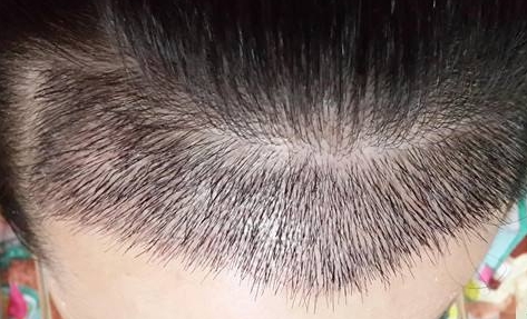 看看這八家贛州整形醫(yī)院有沒有靠譜的？你知道嗎？