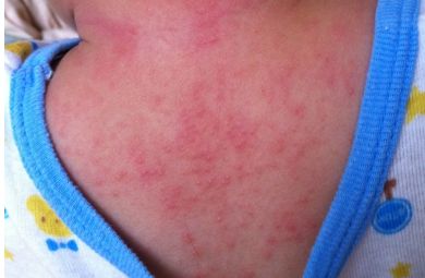 大家對重慶當代整形醫(yī)院醫(yī)生謝錦清的技術(shù)有何評價？附有最新隆鼻案例和醫(yī)療解析