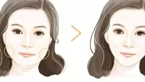 北京哪家整形醫(yī)院的隆鼻效果好？排行榜公開！