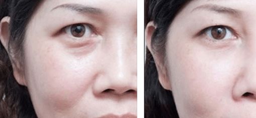 富陽區(qū)去疤整形哪家醫(yī)院口碑好？排行榜前六大推薦！醫(yī)術(shù)實(shí)力分享值得借鑒