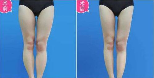 武漢哪家醫(yī)療機(jī)構(gòu)在正畸美容領(lǐng)域聲名顯赫？中山、美萊為佼佼者！