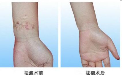 北京自體脂肪隆胸專家真實(shí)排行，專業(yè)技術(shù)精粹一同分享