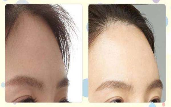 福州哪家醫(yī)院更適合去胎記？如何選擇醫(yī)院進(jìn)行整形手術(shù)？