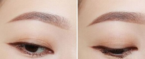 深圳最靠譜的整形美容醫(yī)院推薦，網(wǎng)友大力推薦，不容錯過