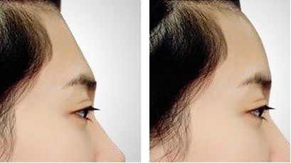 沈陽整形美容醫(yī)院鼻部整形?？祈敿?jí)醫(yī)院匯總，不容錯(cuò)過，速來圍觀