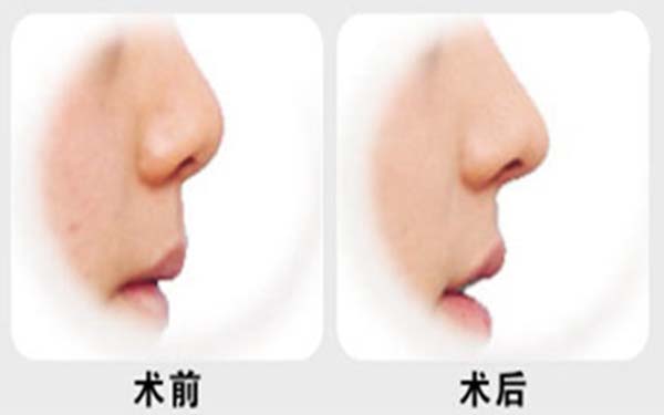 鄭州美美醫(yī)療整形美容醫(yī)院靠譜嗎？如何詳細(xì)介紹？