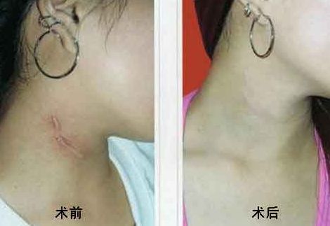 重慶乳房整形六大權(quán)威醫(yī)生盤點(diǎn)，高素質(zhì)專家排行曝光