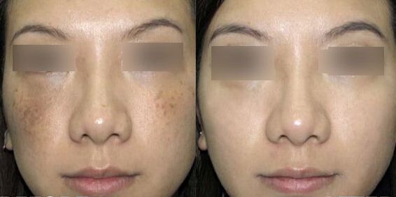 揭秘南京鼻王身份！專家盛贊前五強(qiáng)醫(yī)生，引人入勝！