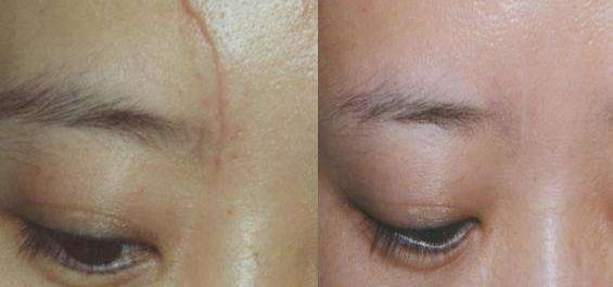 北京隆鼻哪里做得好？美容大夫們看好的三家醫(yī)院參考